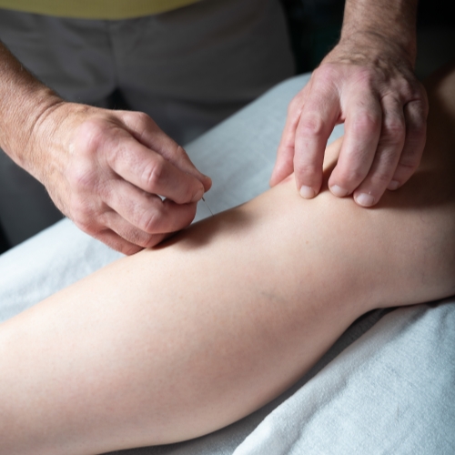 acupuncture-Loop-Physical-Therapy-Chicago-IL-01