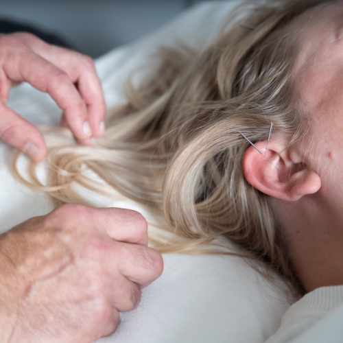 acupuncture-Loop-Physical-Therapy-Chicago-IL-03